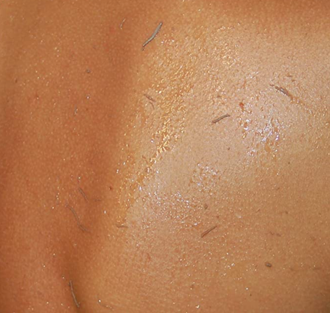 Clean and wet skin is shown