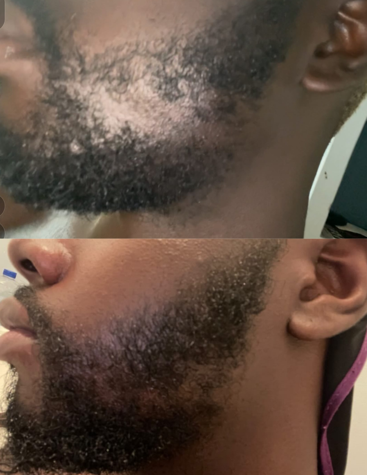 Before and after is shown of a male model and his previously patchy beard and now a more healthy and full beard