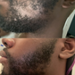 Before and after is shown of a male model and his previously patchy beard and now a more healthy and full beard 